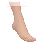 Hard feet