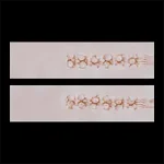 1) - 10.2cm