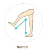 Normal