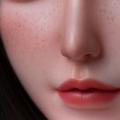 Facial Freckles