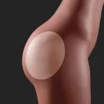 Gel Butt