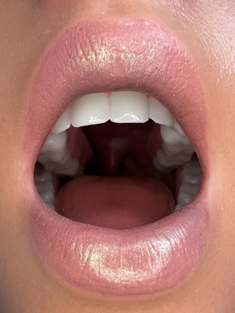 Realistic Oral System 3