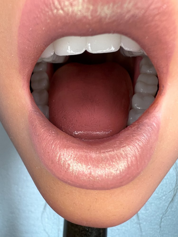 Realistic Oral System 2